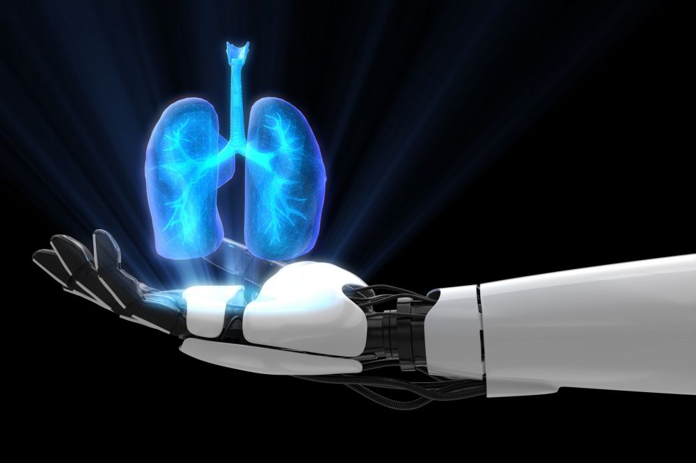 Une intelligence artificielle permet de diagnostiquer le cancer du poumon 